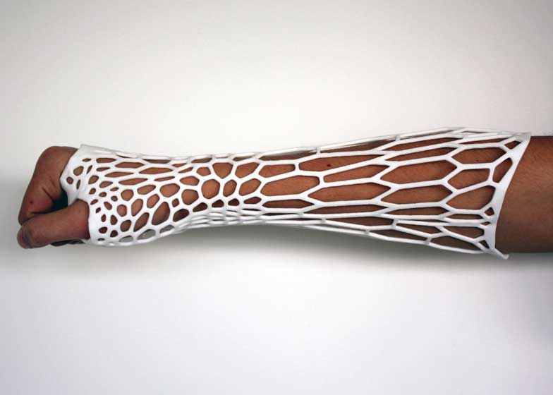 3d printed cast